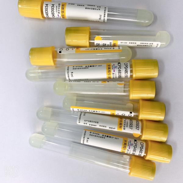 O vácuo exato médico do tubo 3ml 4ml 5ml do gel e do ativador do coágulo tira o volume