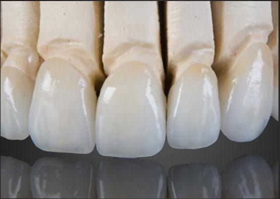 Wieland Zirconia All Ceramic Crown Inner Painting Customized With CAD Design