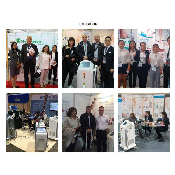 TGA Hair Removal Beauty Machine 808nm 755nm 1064nm Diode Laser Therapy System