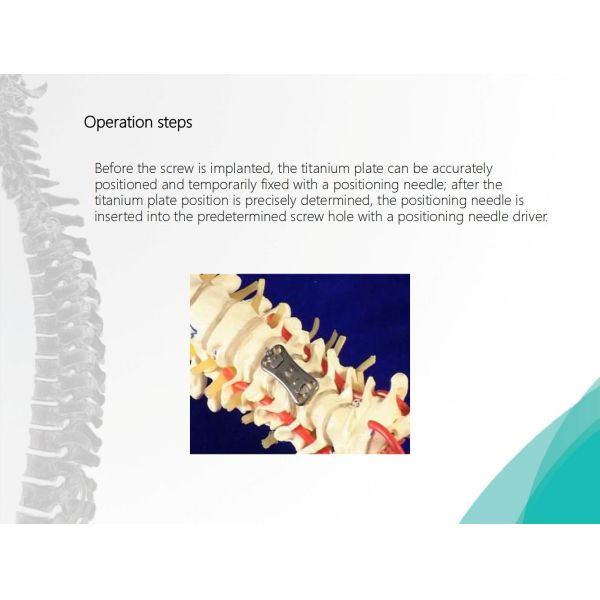 Spine Anterior Cervical Plate Titanium Cervical Plate Implant Orthopedic Surgery CE Certification