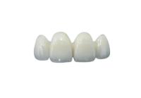 Coroa dental da zircônia altamente Biocompatible menos a resistência de abrasão sensível