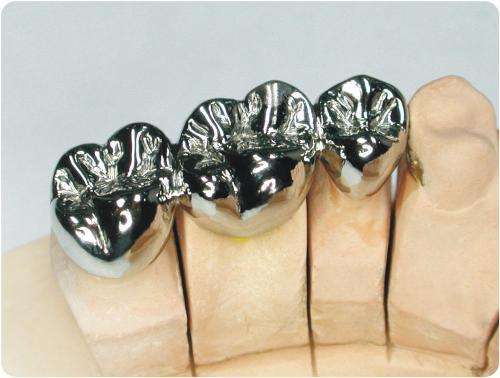 Cobalt Chromium Alloy Dental Crown with CAD/CAM Milling for High Tensile Strength and Permanent Restoration