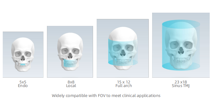 Dental Implant Orthodontic CBCT System High-Resolution 3D Imaging for Precise Diagnosis