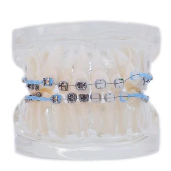 Multi Color Human Teeth Model For Study Dental Orthodontic Teeth Model With Bracket