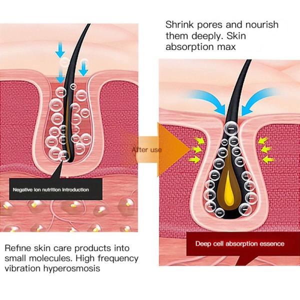 1.5V привело подмолаживание кожи Handheld анти- приборов вызревания лицевых перезаряжаемые фотонное