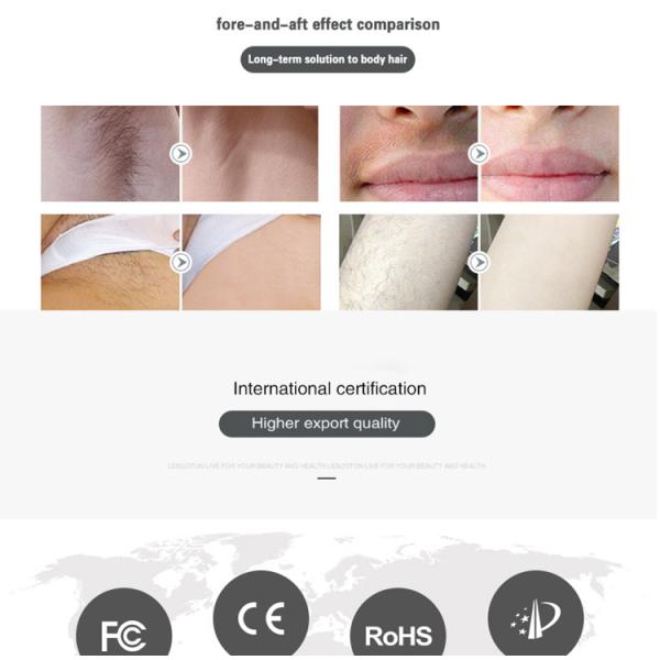 Painless Permanent Hair Removal Home Devices 300000 Pulses For Facial Body Bikini