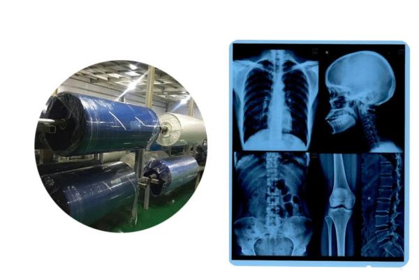 11X14 Inch Medical X-ray Film/Analogue Medical Film/Dry Film