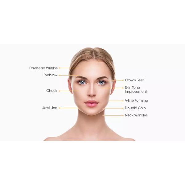 Anti aging Acne Removal Color Screen Thermagic RF Beauty Machine For Salon