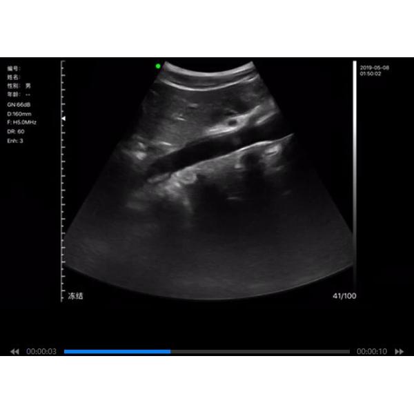Wireless Ultrasound Probes Handheld Ultrasound Device With B, B/M, Color Doppler, PW, Power Doppler Mode 192 Elements
