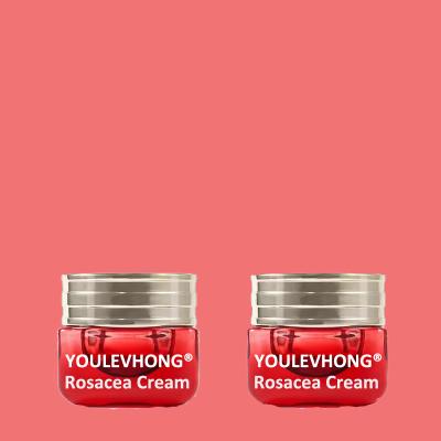 Cream para Rosacea para todos os tipos de pele