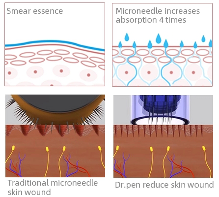 X5 Electric Derma Pen Stamp 9/12/36/42/Nano Needle Cartridges for Neck/Throat Target Area
