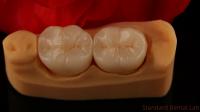 Couronne en zirconium à contour complet Forteur et esthétique exceptionnelles Pas de revêtement en porcelaine Couronne postérieure Laboratoire dentaire chinois