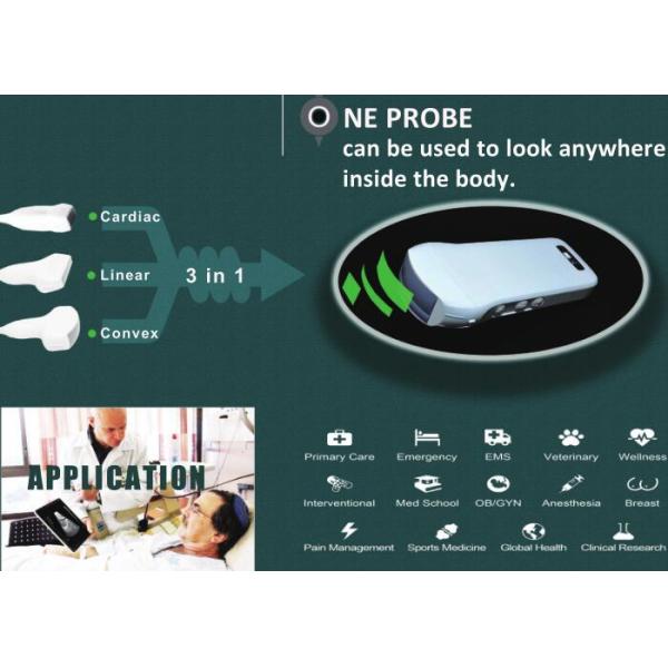 3 EN 1 escáner portátil del ultrasonido del PDA inalámbrico que trabaja con la medida obstétrica del peso 227g del APP solamente disponible