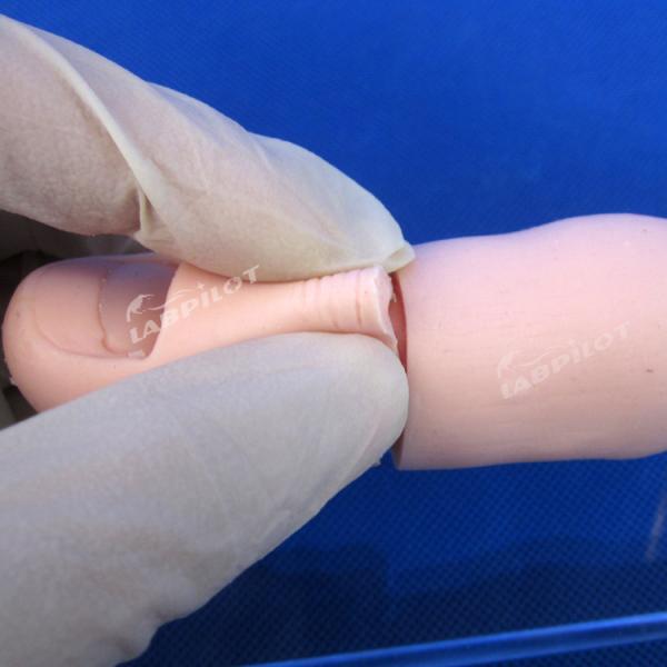 Ingrowing Toenail Trainer The Ultimate Model for Nails Extraction Training and Practice