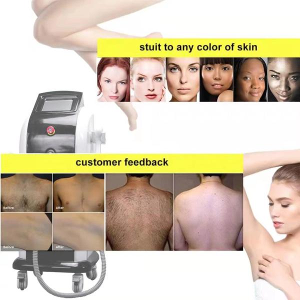 IPL SHR Diode Laser Hair Removal Face , Black Skin Painless 3 Wave Ice Diode Laser
