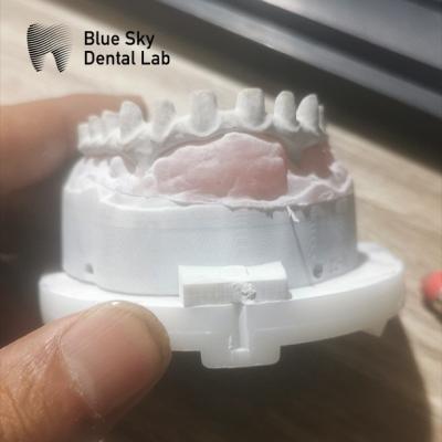Customizable Industrial Malo Bridge In Silver And Gold Malo Implant Bridge