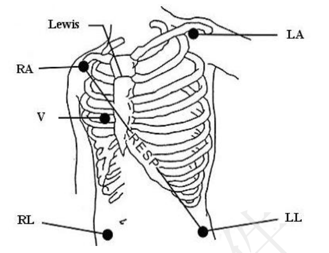 REF EL05DASY кабеля кнопки AHA многоразовый ECG руководства Edan 5 для ransmitter телеметрии Edan iT20