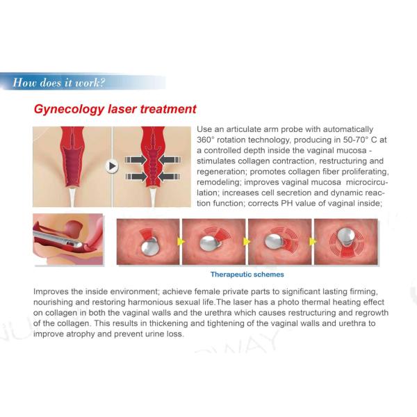 2017 New Arrivals USA RF Tube Fractional Co2 Laser For Skin Rejuvenation And Scar Removal