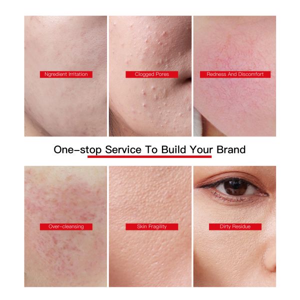 Factory Latest Recombinant Type III Humanized Collagen Gentle Cleansing Sensitive skin 0 irritation strong repair fade redness