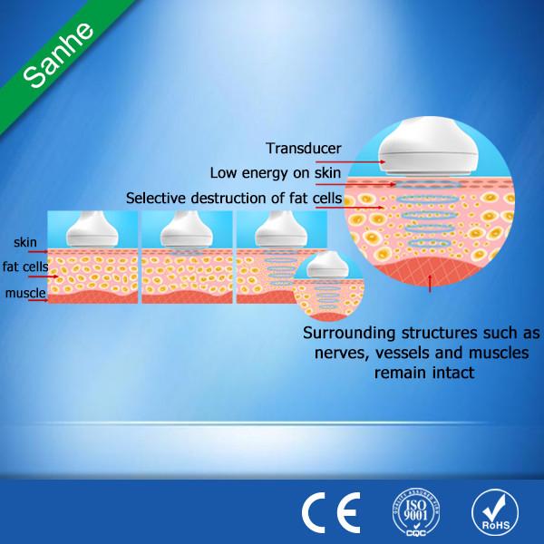 2016 Sanhe HIFU for face lifting and body slimming and weight loss ultrasound focus equipment