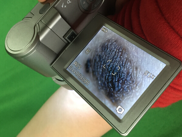 3 pulgadas de TFT LCD Dermatoscope video con la batería recargable 3.7V/1050mAh del litio para la inspección del pelo y de la piel