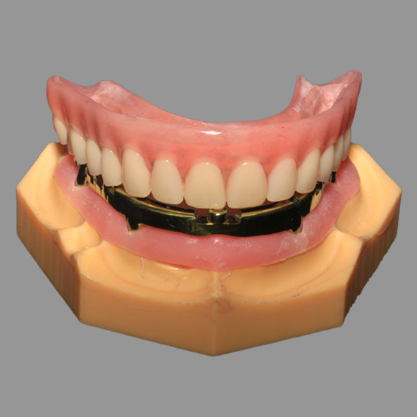 Full Acrylic Denture All On X Dental Implants AOX Class 4 With Locator Attachment