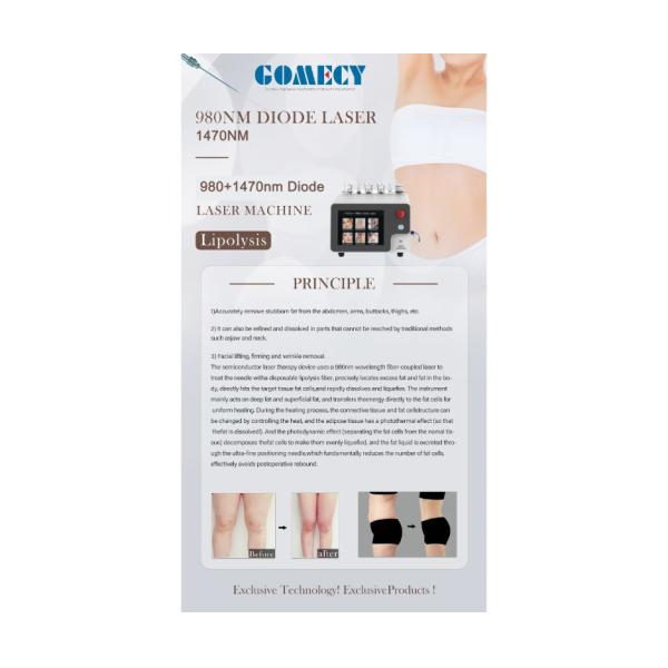 980 1470Nm Vaser Laser Plastic Surgery Laser Machine Liposuction Facelift Laser For Sale