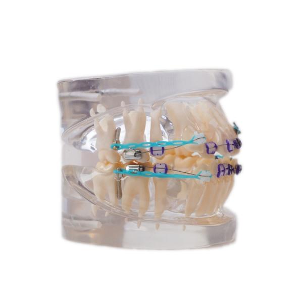 Multi Color Human Teeth Model For Study Dental Orthodontic Teeth Model With Bracket