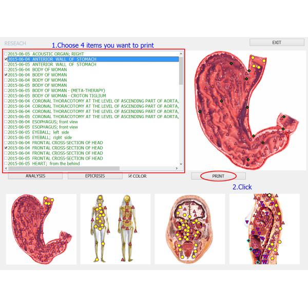 Clinical Examination Aids Full Body Health Analyzer 8d Nls Health Analyzer