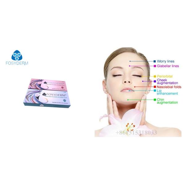 Hyaluronic кисловочный заполнитель геля дермальный для губ сморщивает заполнитель