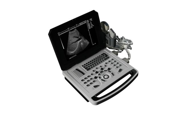 Ginecologia da obstetrícia do ultrassom de Doppler da cor de Ecografo Portatil 3D 4D 5D