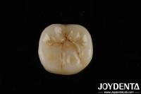 Alta translucidez Zirconia completa con capas Biocompatibilidad y resistencia a la flexión de 800 MPa