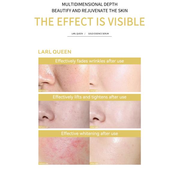 Etiqueta personal personalizada Cosméticos para el cuidado de la piel facial Esencia de suero Niacinamida aclarante Hidratante Esencia blanqueadora