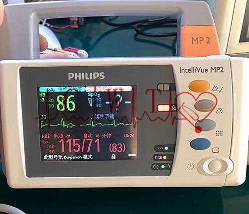 Philip MP2 a employé le moniteur patient