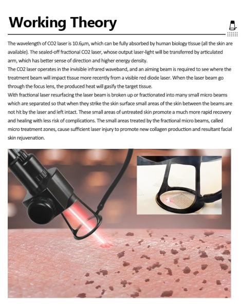 Fractional Co2 Laser Price Acne Scar Removal Product Stainless Brass Carbon Steel Laser Cutting Machine