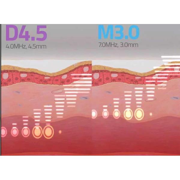 Ultrasonic 2 In 1 HIFU Machine For Women Tightening Rejuvenation