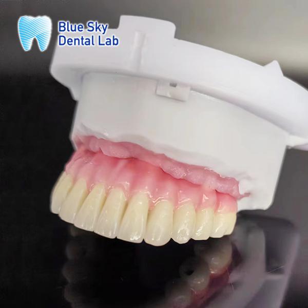 Cas d'implant de la bouche entière personnalisé Compatibilité universelle