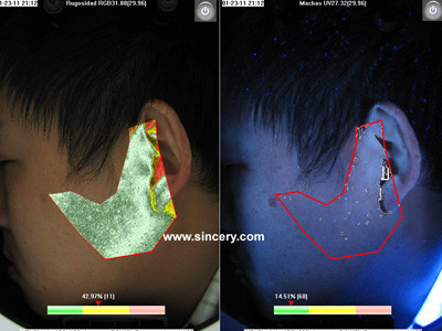 3: 4 Preview system, and Front slant window Facial Skin Analyzer Magic Mirror BS-3200