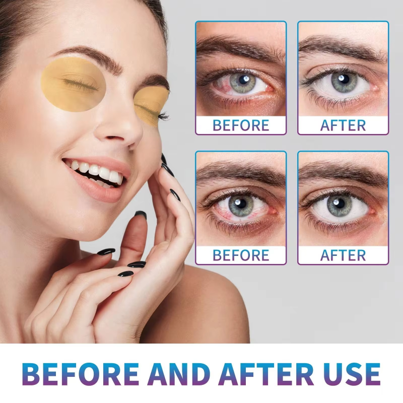 OEM ODM Lutein Collagen Hydrogel Eye Patch Moisturizing Cold Compress Mask For Eye