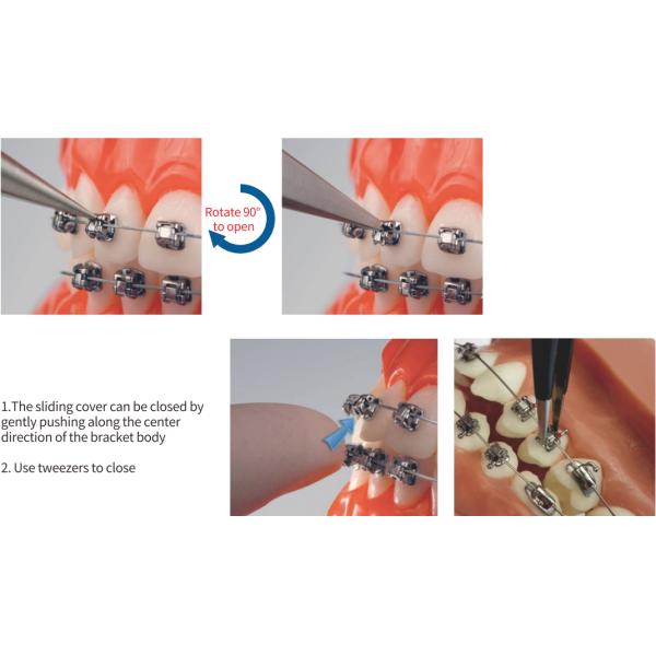 20pcs Roth MBT Brackets Dental Orthodontic Braces