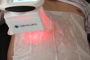 тело лазера красного света RF частоты 5M RF уменьшая ручки вакуума 2 терапией Cryo машины 92*75.5*44CM