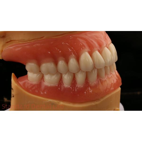 Heat Cured Ivoclar Full Acrylic Denture Dental Lab High Accuracy High Esthetic Advantage