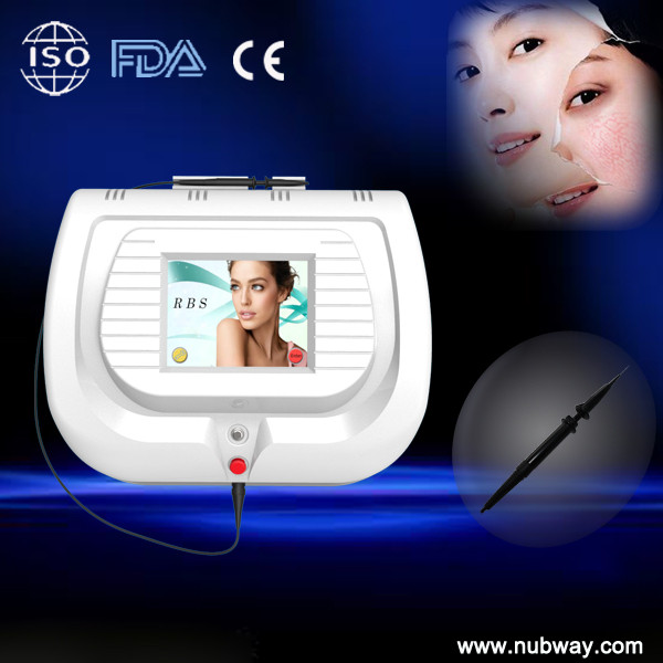 2014 Newest Pain Free Facial Laser Spider Vein Removal
