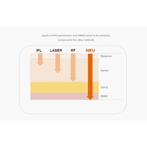 Medical Home Hifu Machine 10 - 11 Line Adjustable Ultrasound Skin Treatment