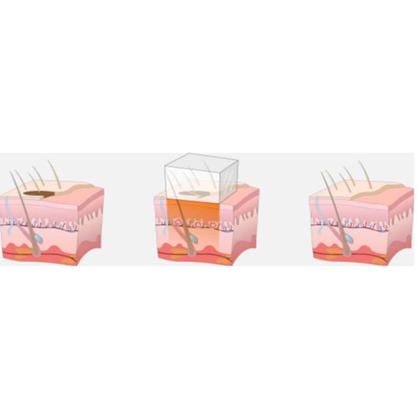 Portable Intense Pulsed Light IPL Hair Removal Machine For Skin Rejuvenation