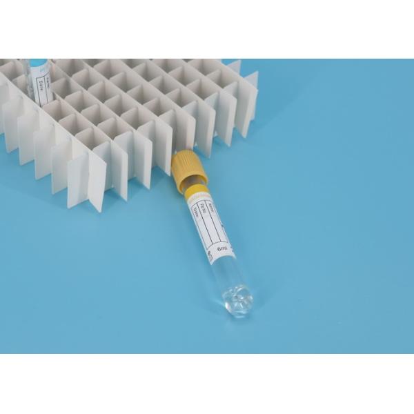 Трубка центрифуги образца сыворотки лаборатории АИК, трубки гепарина