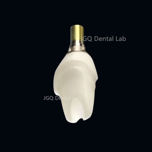 Custom Milled Dental Implant Abutments in Titanium Zirconia FDA CE Certification
