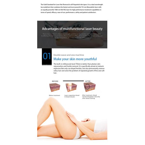 ND:YAG Laser Hair Removal Treatment Equipment 755nm 1064nm Long Pulse Laser Hair Reduction For Dark Skin