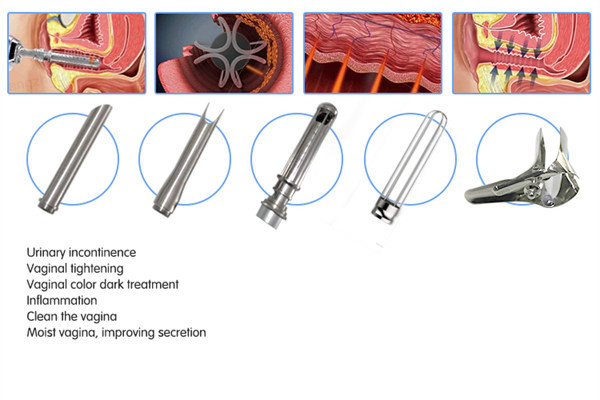Scars 110V To 250V Fractional Radio Frequency Machine