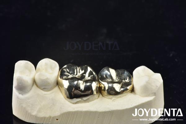 Wax Casting Dental Repair Full Metal Crown For Abrasion Resistant Oral Rehabilitation
